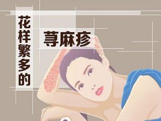 患上了荨麻疹有什么注意事项