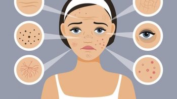 老年斑是什么原因引起的