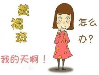 黄褐斑形成之谜：专家解读黄褐斑及治疗方案！